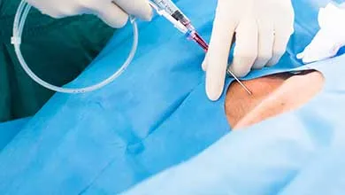 Close-up of a gloved hand inserting a syringe needle into a patient’s neck, with the area covered by a sterile drape.